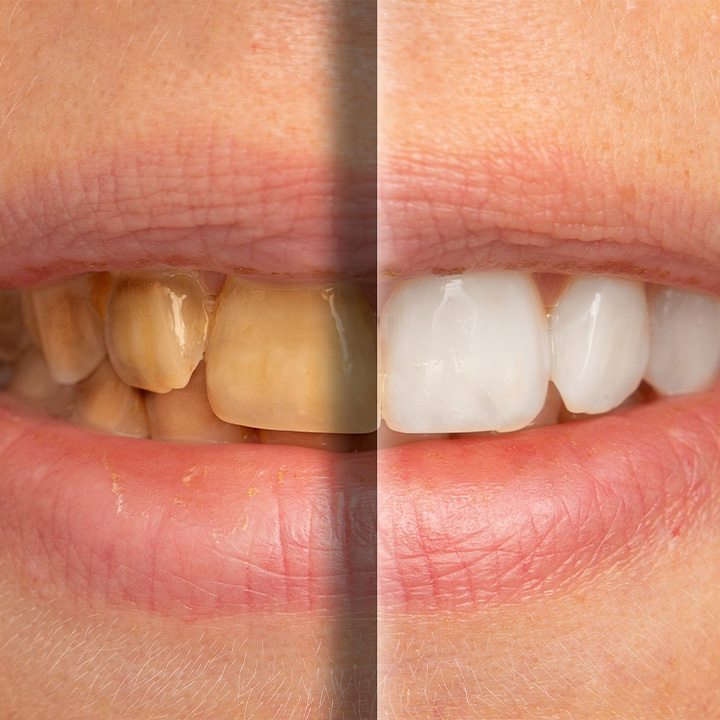 Is Cosmetic Dentistry Right for You? Is Cosmetic Dentistry Right for You?