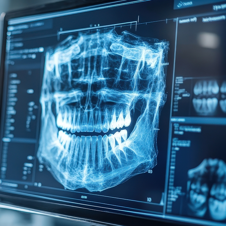Full Mouth Dental Reconstruction – Best Prices for Dental Tourism in Tirana Albania Full Mouth Dental Reconstruction - Best Prices for Dental Tourism in Tirana Albania